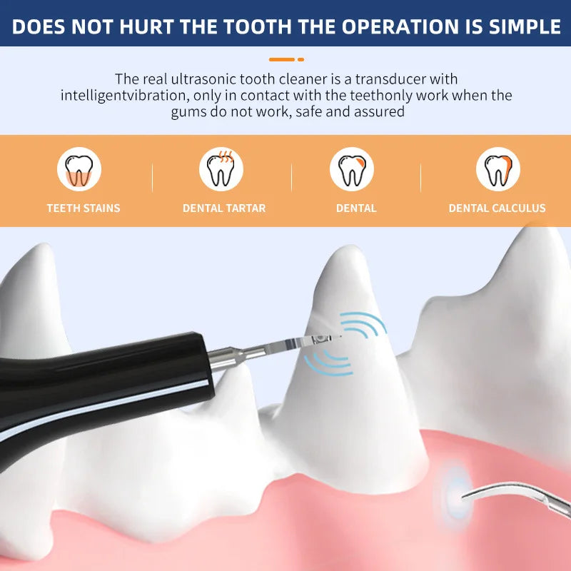 Electric Pet Teeth Cleaning Kit